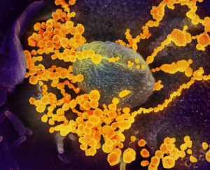 A scanning microscope image of some unidentified microorganisms, colorized in yellow.